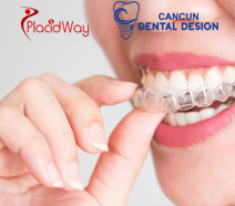 Slider image (10) Cancun Dental Design